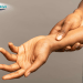 Wrist Replacement vs Wrist Fusion: Which is Better in Turkey?